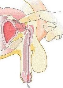 Masaža prostate