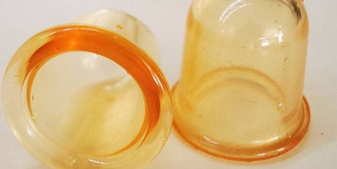 čaše za liječenje prostatitisa